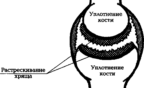 Евдокименко. Артроз. Избавляемся от боли в суставах