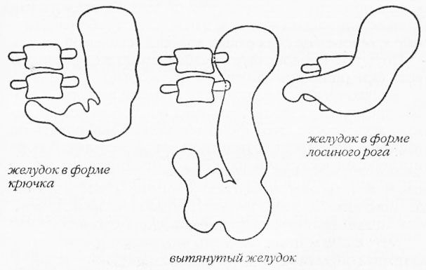 Раздельное питание. Новый подход к диете и здоровому питанию