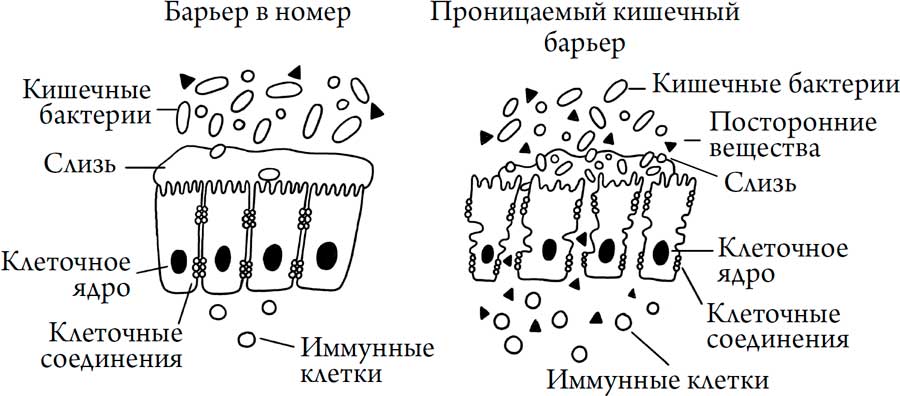 Человек Противный. Зачем нашему безупречному телу столько несовершенств