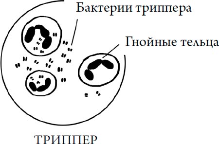 Человек Противный. Зачем нашему безупречному телу столько несовершенств