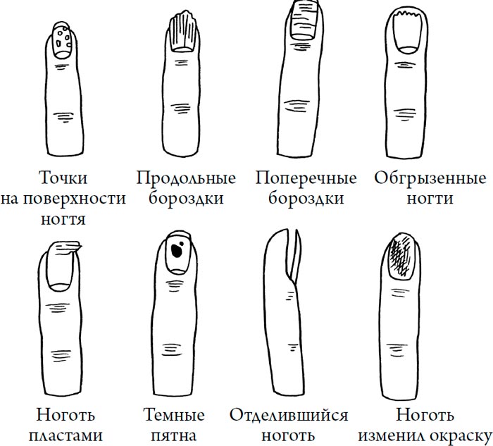 Человек Противный. Зачем нашему безупречному телу столько несовершенств