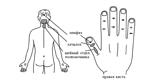 Акупунктура